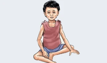 मधेसका १६ प्रतिशत बालबालिकामा कुपोषण